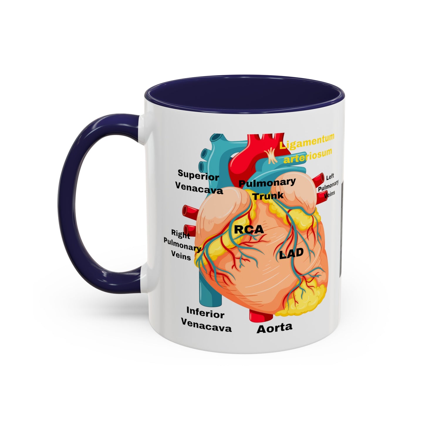 Cardiovascular Design Coffee Mug (11oz)