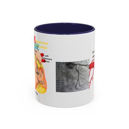 Cardiovascular Design Coffee Mug (11oz)