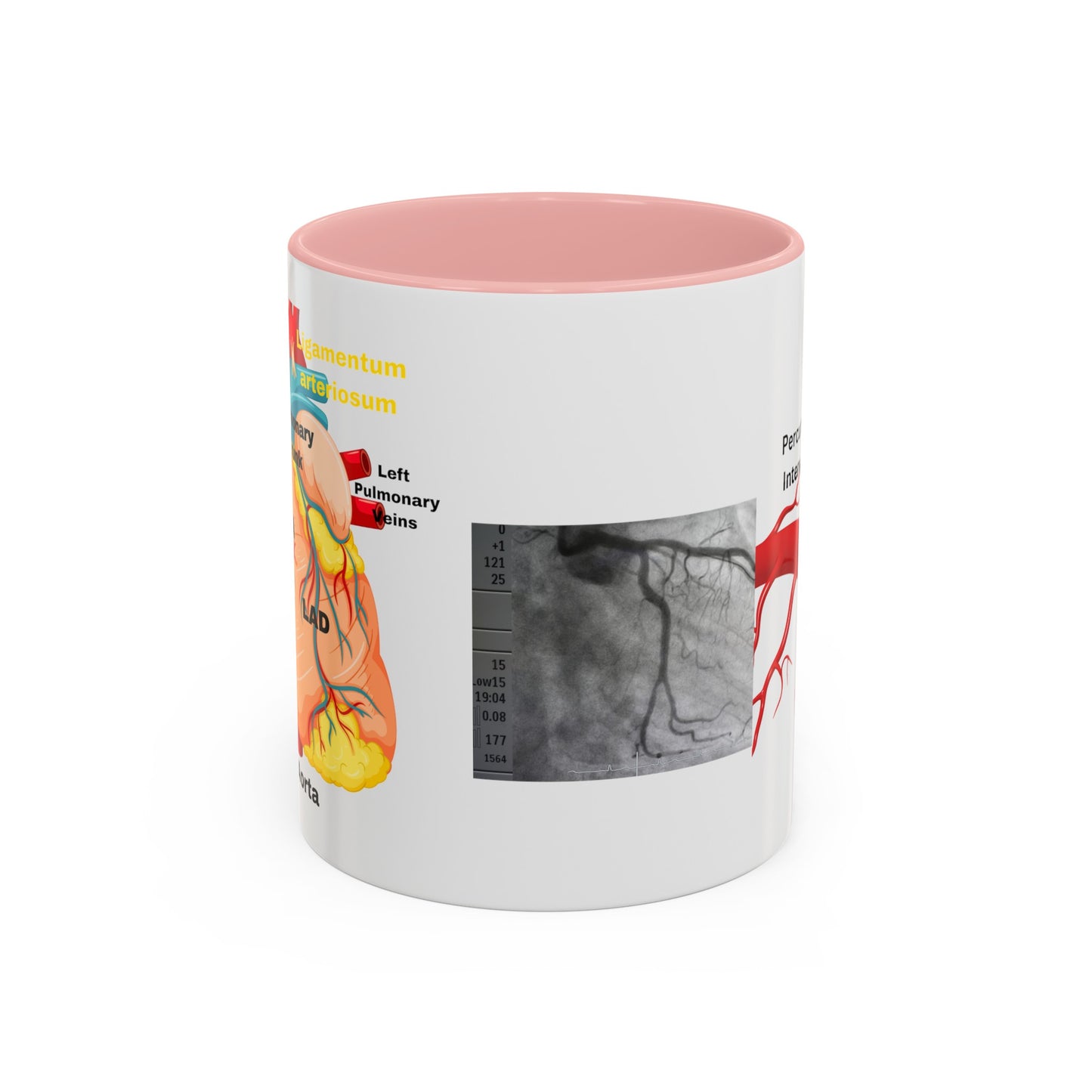 Cardiovascular Design Coffee Mug (11oz)