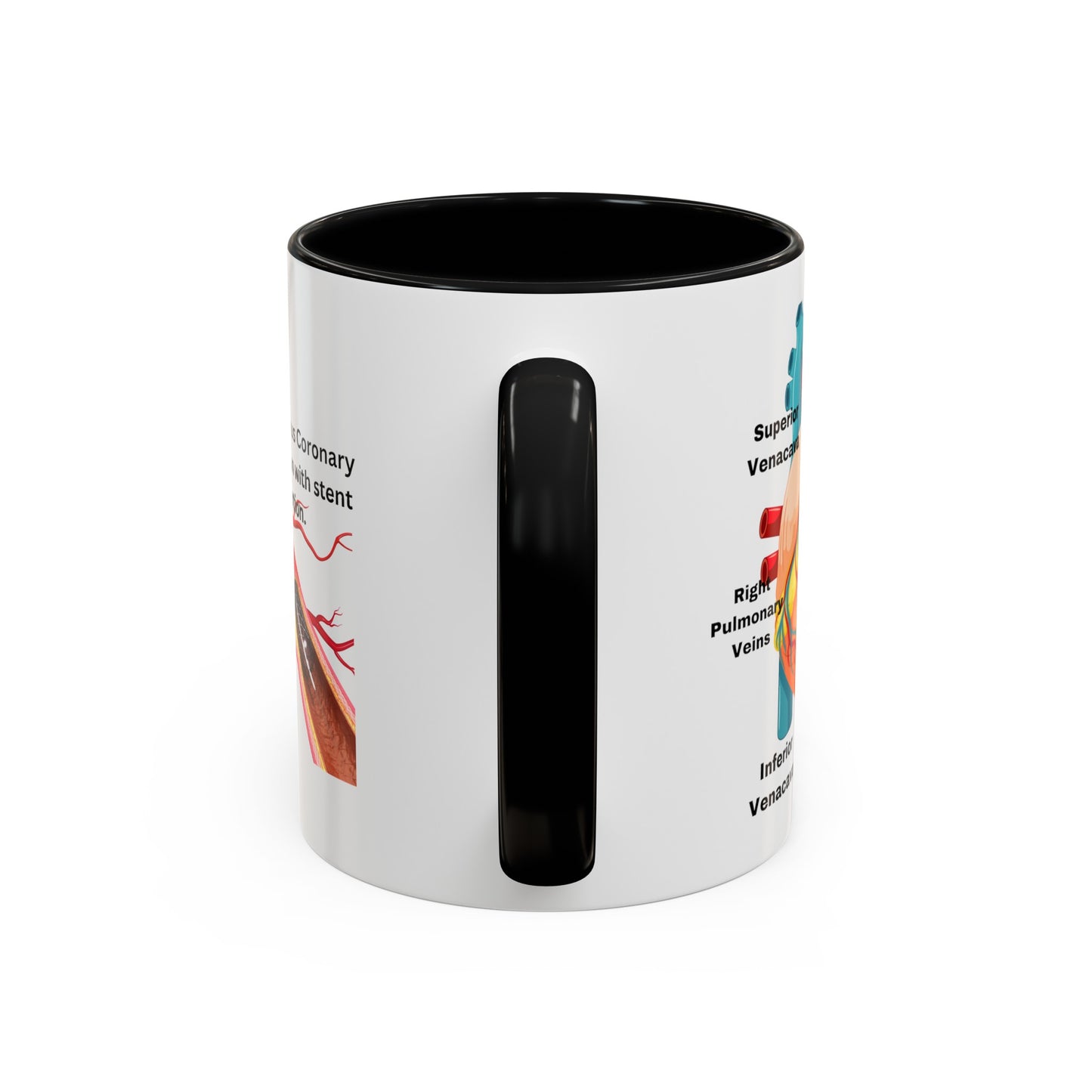 Cardiovascular Design Coffee Mug (11oz)